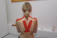 ukázka rehabilitace v pardubicích